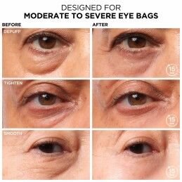 It Cosmetics|Creme para o Contorno dos Olhos It Cosmetics Bye Bye 15 ml